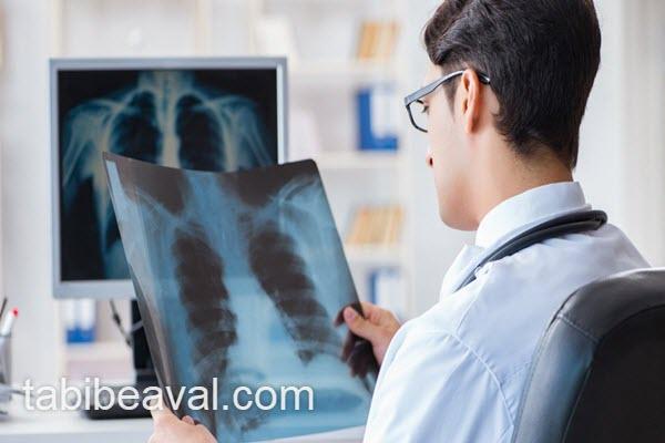 رادیولوژی در منزل با بهترین کیفیت | طبیب اول