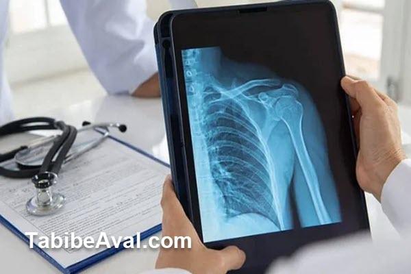 مزایای رادیولوژی در منزل چیست؟