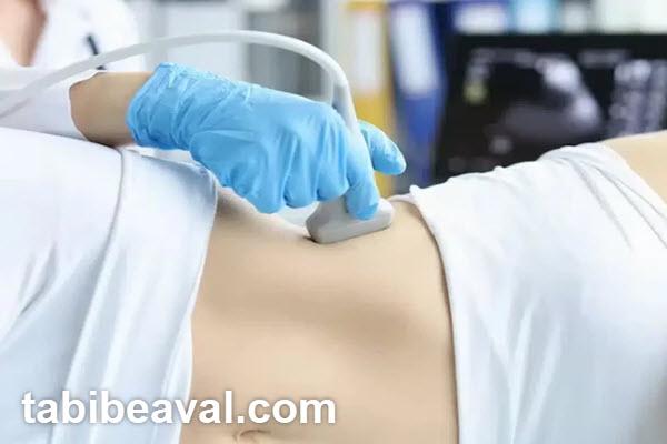 سونوگرافی کبد در منزل ولنجک