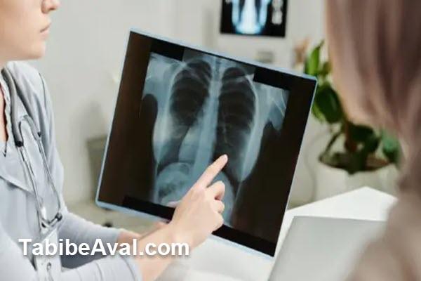 انجام خدمات رادیولوژی در منزل تجریش