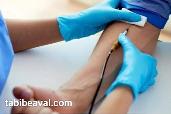 نحوه دریافت خدمات آزمایش در منزل