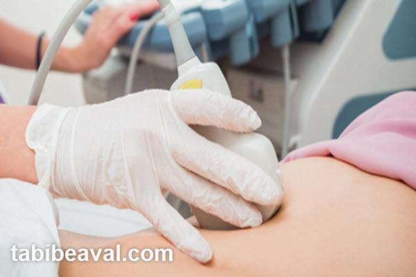 فرآیند انجام سونوگرافی شکم در منزل