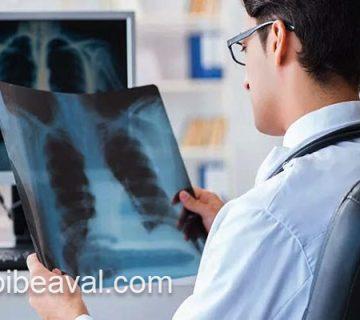 انجام رادیولوژی در منزل | طبیب اول