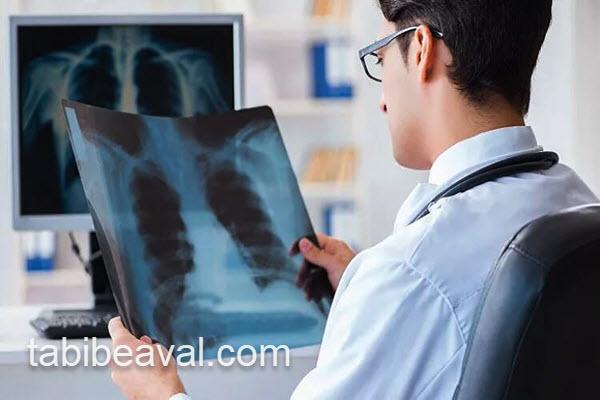 انجام رادیولوژی در منزل | طبیب اول