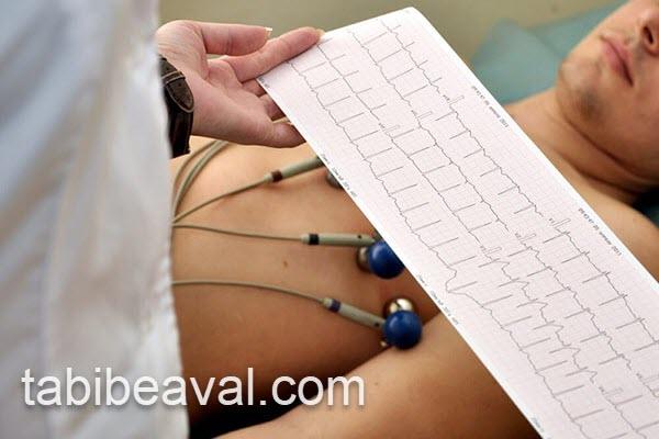 انجام تست نوار قلب در منزل | طبیب اول