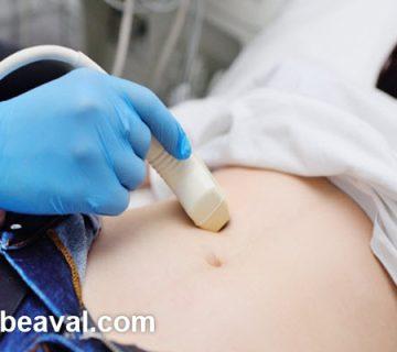 سونوگرافی شکم در منزل اقدسیه