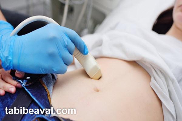 سونوگرافی شکم در منزل اقدسیه