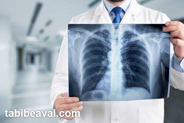 پزشک متخصص ریه در تهرانپارس