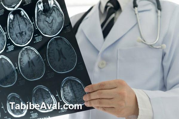 متخصص مغز و اعصاب در منزل در نظام آباد